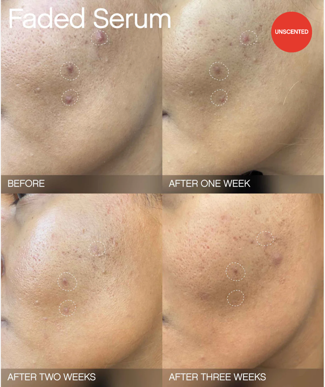 Faded Starter Kit For Discoloration + Uneven Skintone 1.75 fl oz (1 bar) | 15 ml (serum) | 1 pair (eye mask)