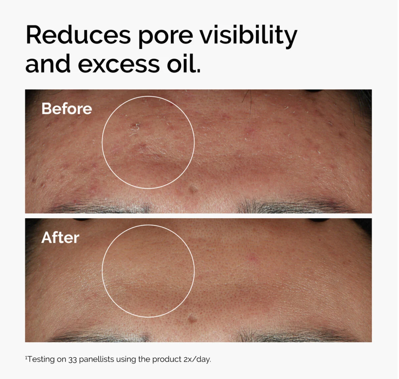 The Ordinary Niacinamide 10% + Zinc 1% 30ml