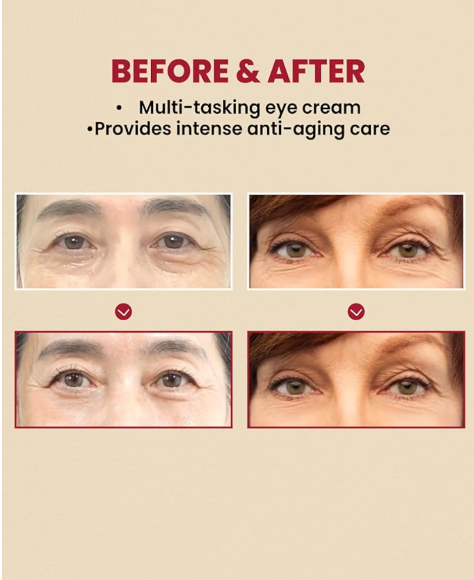 KSECRET SEOUL 1988 Eye Cream : Retinal Liposome 4% + Fermented Bean, wrinkle care, anti-aging, skin elasticity, pigmentation, retinol, 30ml/1.01 fl.oz.