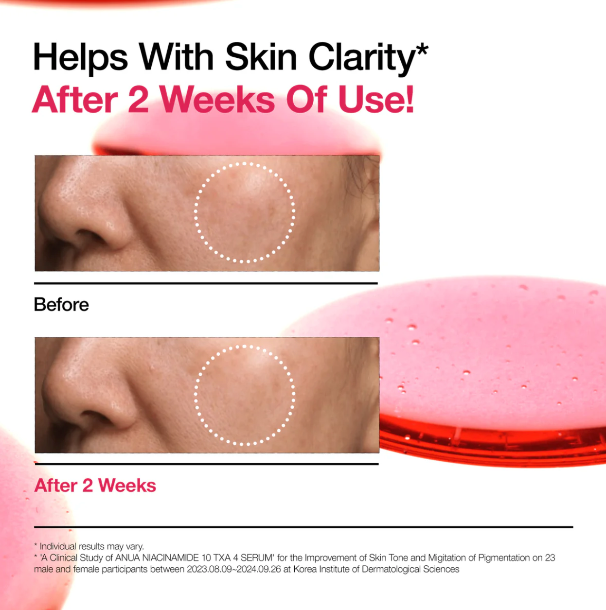 Anua NIACINAMIDE 10%+TXA 4% Serum